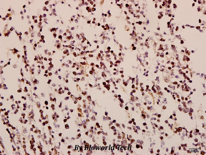 Immunohistochemistry (IHC) analyzes of GNAZ (A12) pAb in paraffin-embedded human tonsil carcinoma tissue at 1:50.