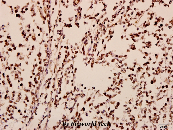 Immunohistochemistry (IHC) analyzes of TIS11B (D88) pAb in paraffin-embedded human tonsil carcinoma tissue at 1:50.