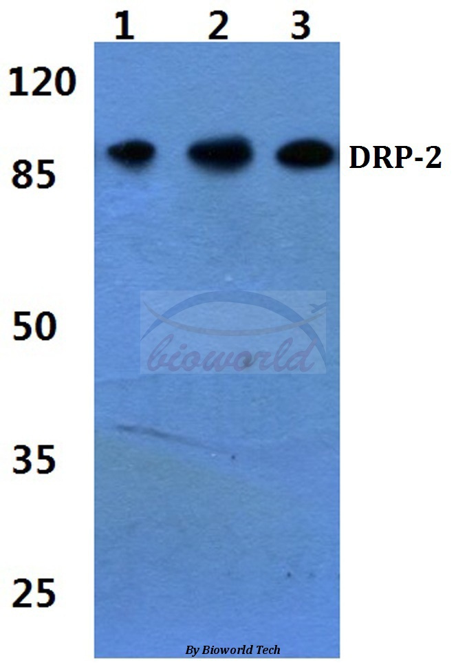 Western blot (WB) analysis of DRP-2 (P510) pAb at 1:500 dilution Lane1:HEK293T cell lysate Lane2:NIH-3T3 cell lysate Lane3:PC12 cell lysate