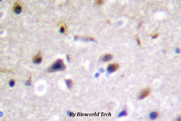 Immunohistochemistry (IHC) analyzes of DRP-2 (P510) pAb in paraffin-embedded human brain tissue .