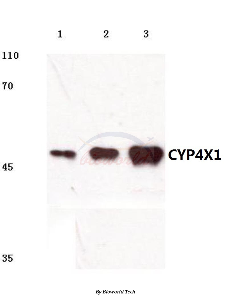 Western blot (WB) analysis of CYP4X1 (V273) pAb at 1:500 dilution Lane1:Jurkat cell lysate Lane2:Mouse Kidney tissue lysate Lane3:Rat Kidney tissue lysate