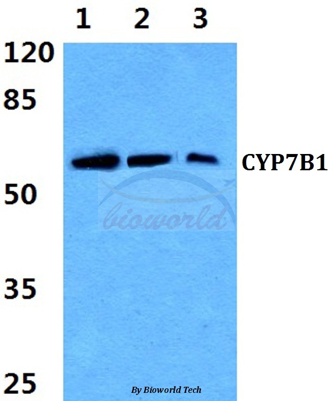 Western blot (WB) analysis of CYP7B1 (Q127) pAb at 1:500 dilution Lane1:DLD cell lysate Lane2:sp2/0 cell lysate Lane3:PC12 cell lysate