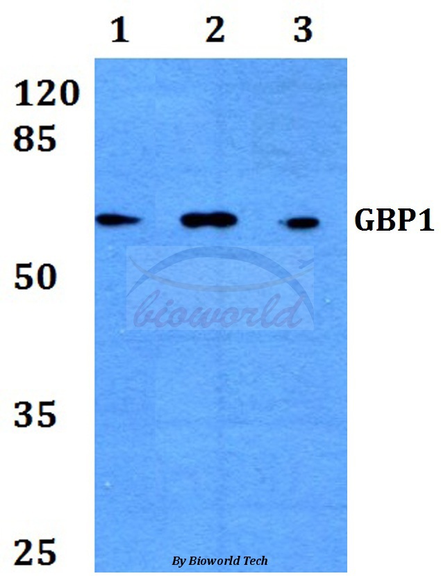 Western blot (WB) analysis of GBP1 (E99) pAb at 1:500 dilution Lane1:HEK293T cell lysate treated with IFN-γ(20ng/ml,15mins) Lane2:Raw264.7 cell lysate treated with IFN-γ(20ng/ml,15mins) Lane3:H9C2 cell lysate treated with IFN-γ(20ng/ml,15mins)