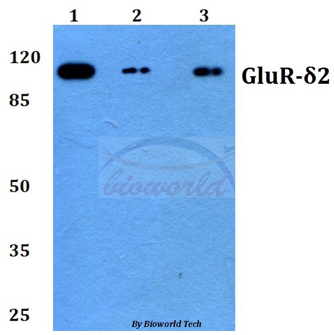Western blot (WB) analysis of GluR-δ2 (G860) pAb at 1:500 dilution Lane1:Hela whole cell lysate Lane2:Raw264.7 whole cell lysate Lane3:PC12 whole cell lysate