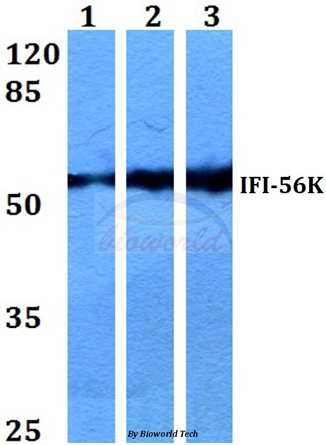 Western blot (WB) analysis of IFI-56K (H63) pAb at 1:500 dilution Lane1:HepG2 whole cell lysate Lane2:Raw264.7 whole cell lysate Lane3:PC12 whole cell lysate
