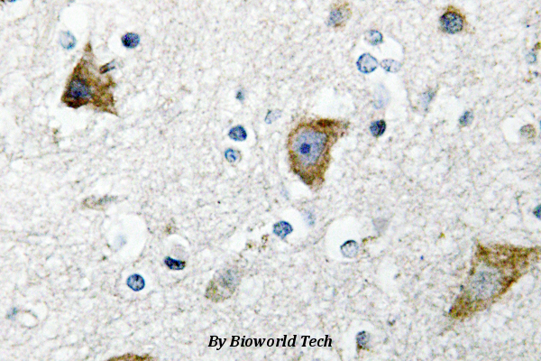 Immunohistochemistry (IHC) analyzes of Ribosomal Protein S20 (K67) pAb in paraffin-embedded human brain tissue.