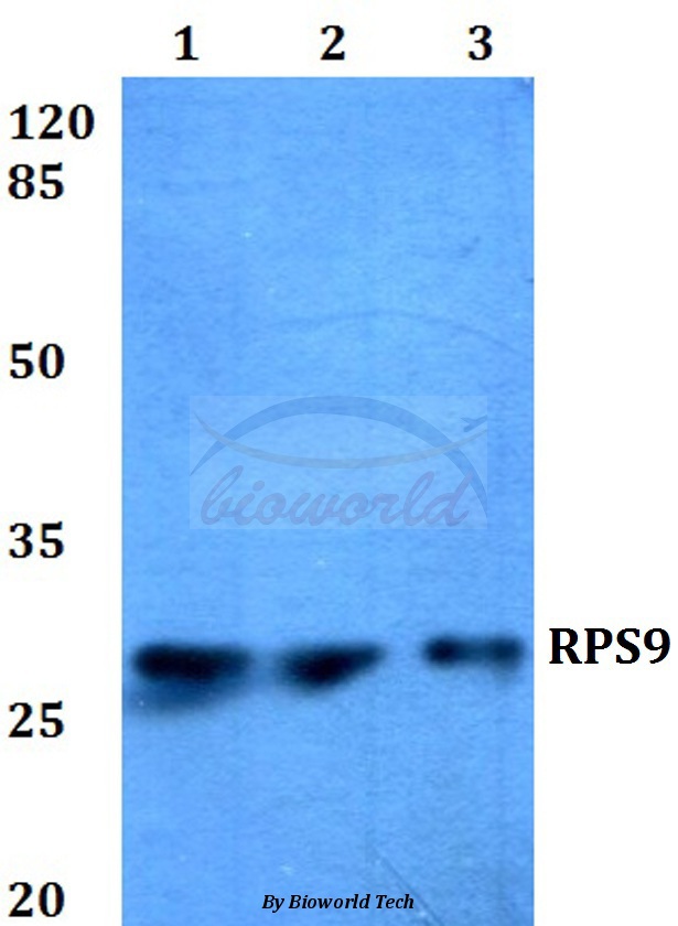 Western blot (WB) analysis of RPS9 (E73) pAb at 1:500 dilution Lane1:HEK293T whole cell lysate Lane2:Raw264.7 whole cell lysate Lane3:H9C2 whole cell lysate