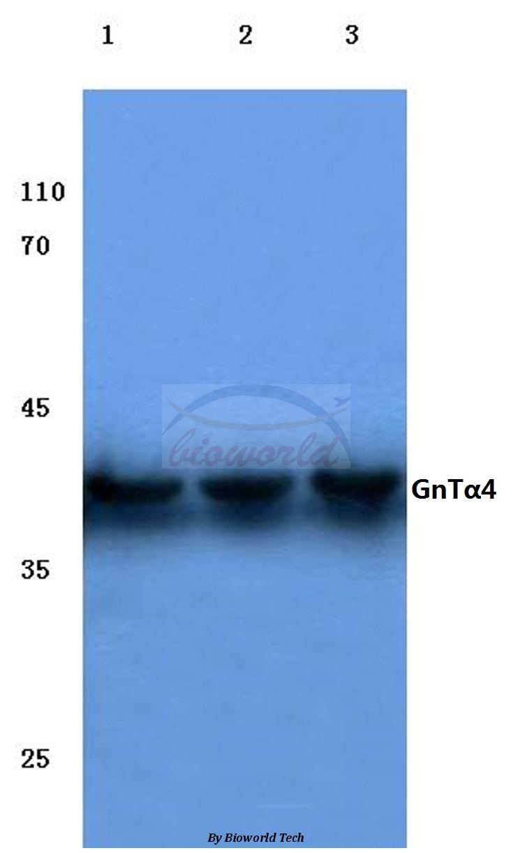 Western blot (WB) analysis of GnTα4 (H65) pAb at 1:500 dilution Lane1:HEK293T cell lysate Lane2:Mouse testis tissue lysate Lane3:Rat kidney tissue lysate