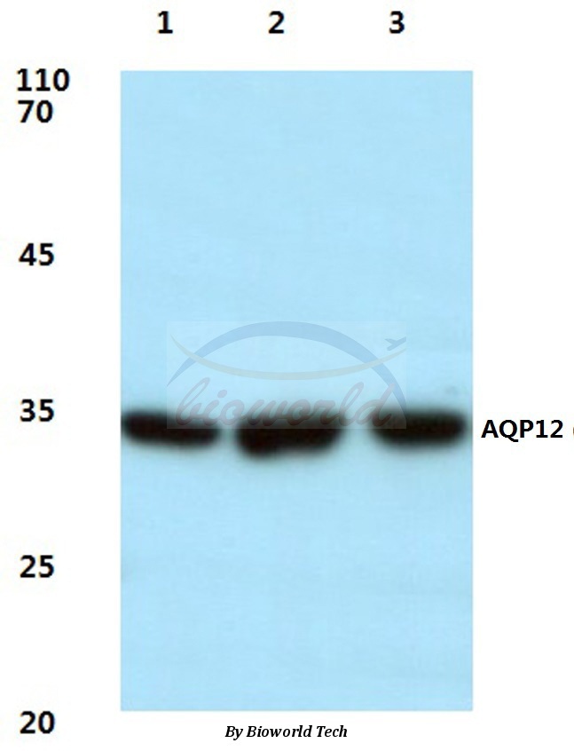 Western blot (WB) analysis of AQP12 (P265) pAb at 1:500 dilution Lane1:HEK293T cell lysate Lane2:Mouse testis tissue lysate Lane3:Rat kidney tissue lysate