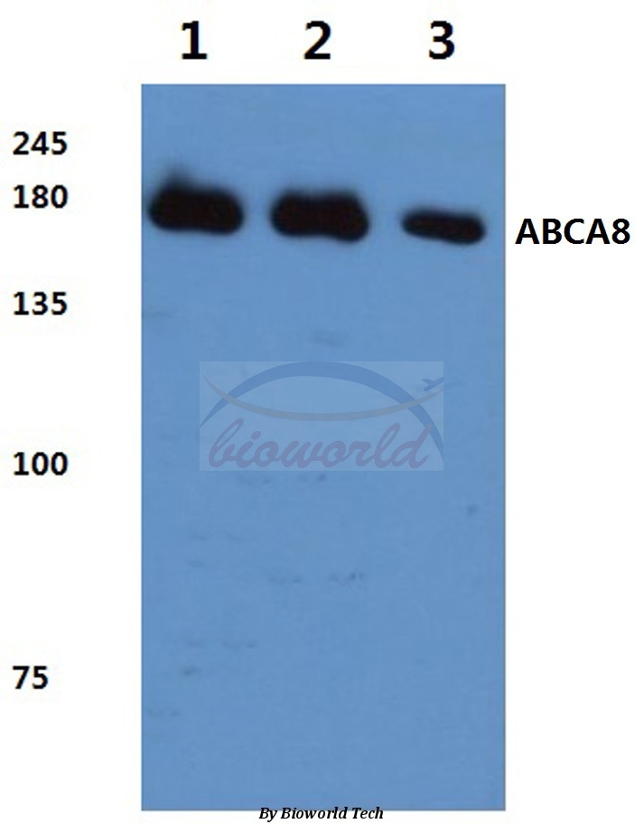 Western blot (WB) analysis of ABCA8 (F1195) pAb at 1:500 dilution Lane1:HEK293T cell lysate Lane2:Raw264.7 cell lysate Lane3:Rat kidney tissue lysate