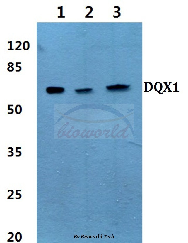 Western blot (WB) analysis of DQX1 (L595) pAb at 1:500 dilution Lane1:HepG2 cell lysate Lane2:Mouse liver tissue lysate Lane3:Rat liver tissue lysate