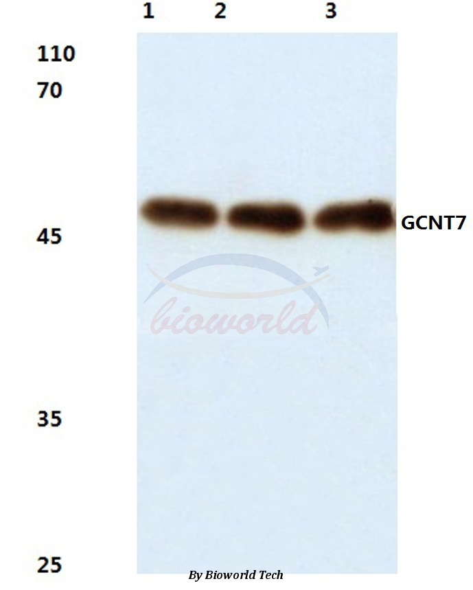 Western blot (WB) analysis of GCNT7 (N349) pAb at 1:500 dilution Lane1:Hela cell lysate Lane2:Mouse kidney tissue lysate Lane3:Rat kidney tissue lysate