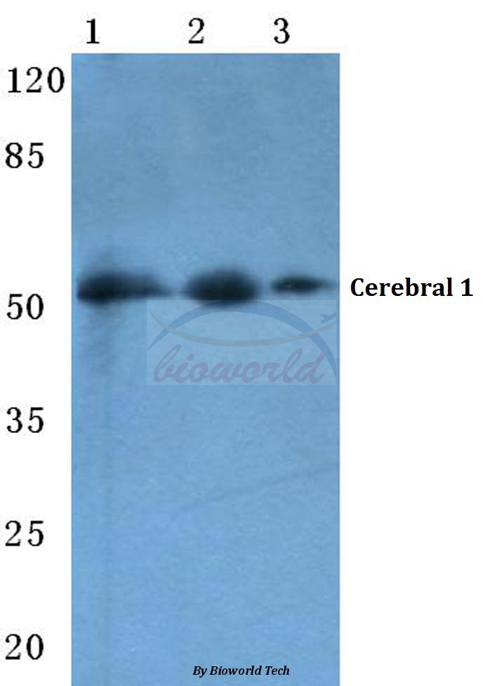 Western blot (WB) analysis of Cerebral 1 (L310) pAb at 1:500 dilution Lane1:Hela cell lysate Lane2:sp2/0 cell lysate Lane3:H9C2 cell lysate
