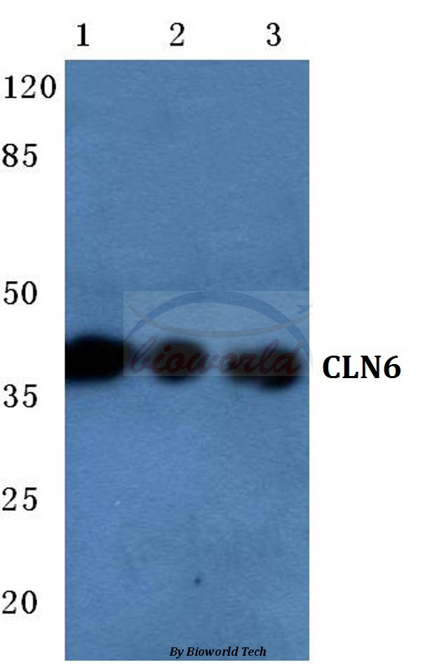 Western blot (WB) analysis of CLN6 (N258) pAb at 1:500 dilution Lane1:HEK293T cell lysate Lane2:NIH-3T3 cell lysate Lane3:PC12 cell lysate
