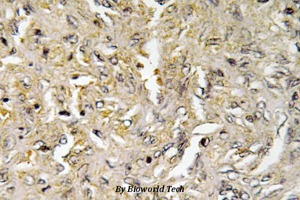 Immunohistochemistry (IHC) analyzes of Claudin-6 (V118) pAb in paraffin-embedded human ovary tissue.
