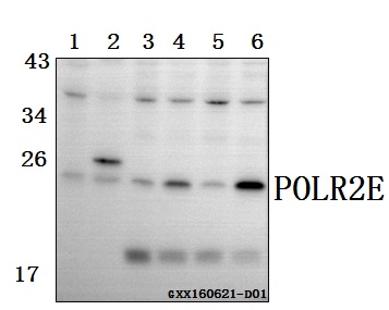 Western blot (WB) analysis of POLR2E (L58) pAb at 1:500 dilution Lane1:CT26 whole cell lysate(40ug) Lane2:PC12 whole cell lysate(40ug) Lane3:PC3 whole cell lysate(40ug) Lane4:HCT116 whole cell lysate(40ug) Lane5:786-O whole cell lysate(40ug)