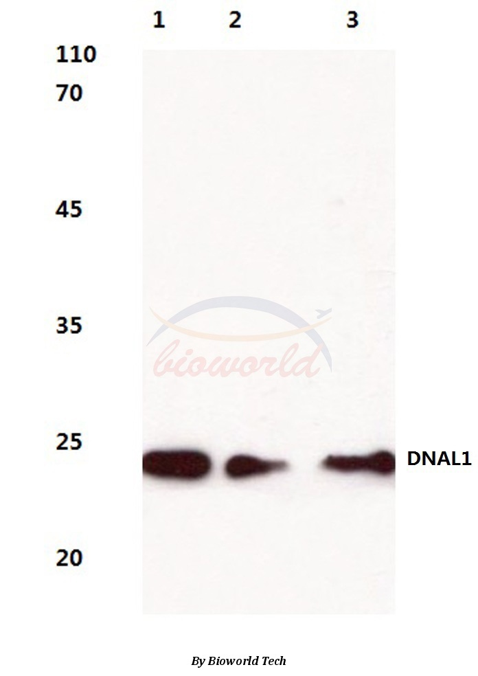 Western blot (WB) analysis of DNAL1 (N161) pAb at 1:500 dilution Lane1:HEK293T cell lysate Lane2:Mouse testis tissue lysate Lane3:Rat kidney tissue lysate