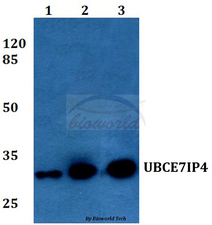 Western blot (WB) analysis of UBCE7IP4 (R184) pAb at 1:500 dilution Lane1:HEK293T whole cell lysate Lane2:Raw264.7 whole cell lysate Lane3:H9C2 whole cell lysate