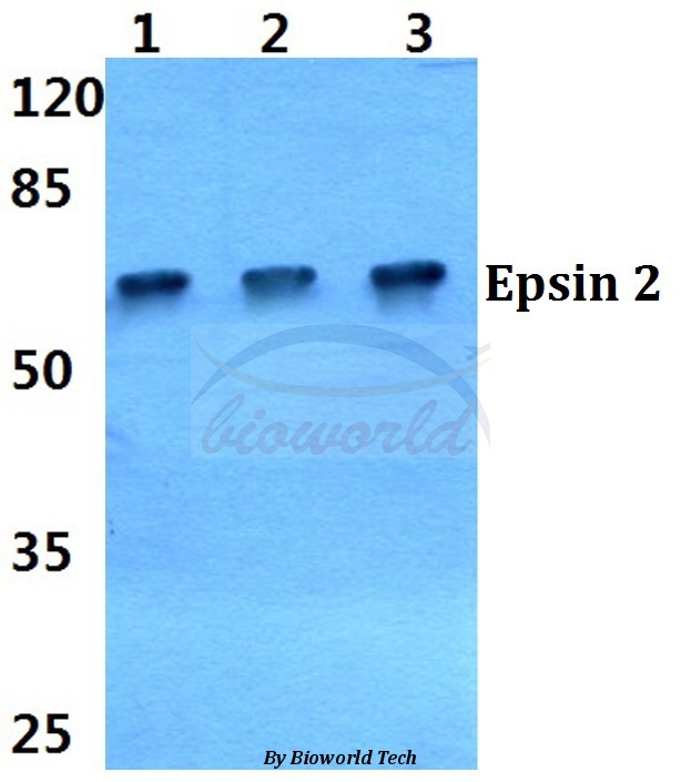 Western blot (WB) analysis of Epsin 2 (L304) pAb at 1:500 dilution Lane1:Hela cell lysate Lane2:sp2/0 cell lysate Lane3:PC12 cell lysate