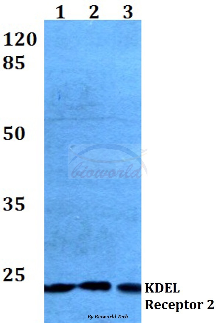 Western blot (WB) analysis of KDEL Receptor 2 (L119) pAb at 1:500 dilution Lane1:HEK293T whole cell lysate Lane2:Raw264.7 whole cell lysate Lane3:H9C2 whole cell lysate