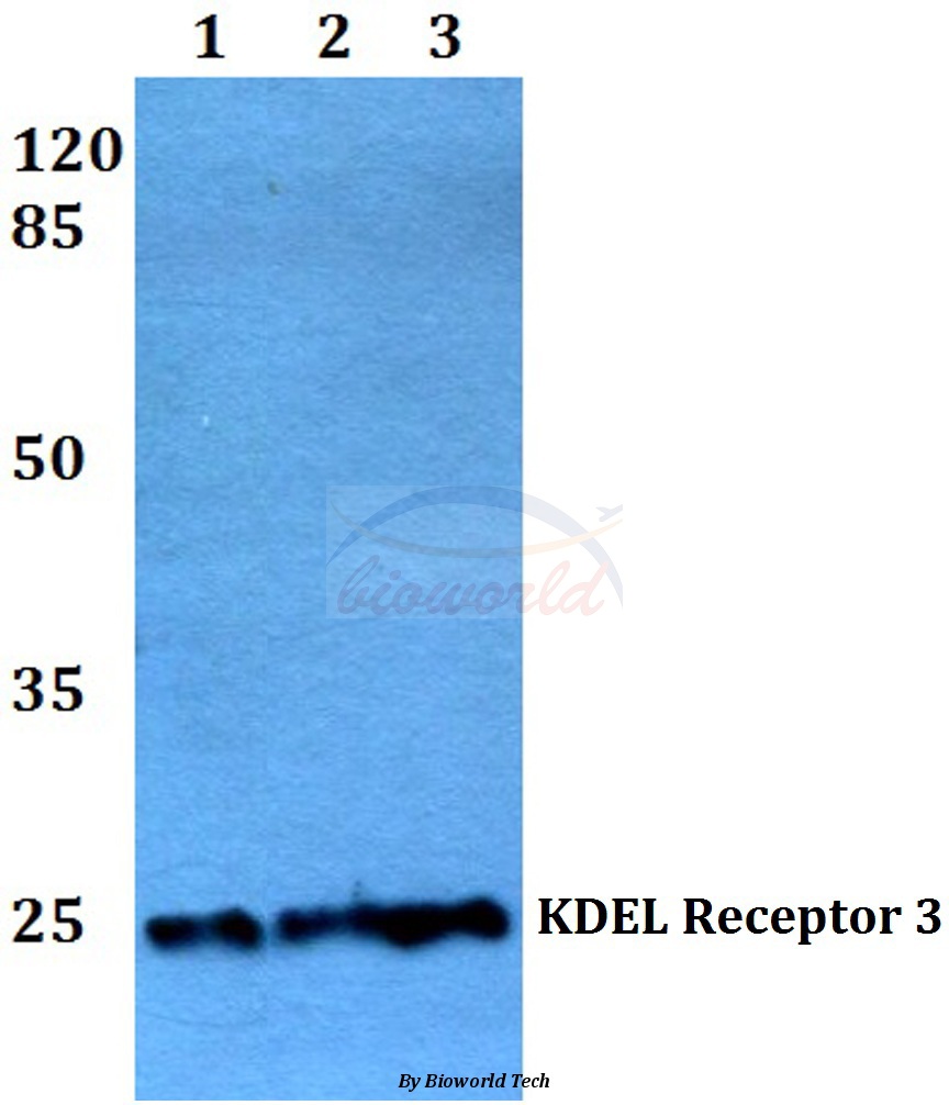 Western blot (WB) analysis of KDEL Receptor 3 (L95) pAb at 1:500 dilution Lane1:A549 whole cell lysate Lane2:Raw264.7 whole cell lysate Lane3:H9C2 whole cell lysate