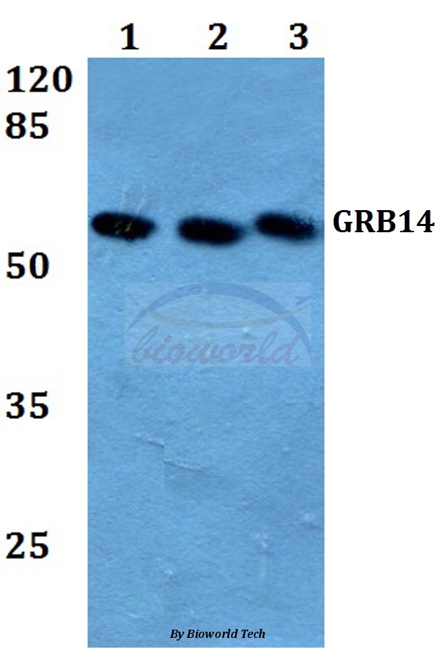 Western blot (WB) analysis of GRB14 (D123) pAb at 1:500 dilution Lane1:MCF-7 whole cell lysate Lane2:Raw264.7 whole cell lysate Lane3:PC12 whole cell lysate