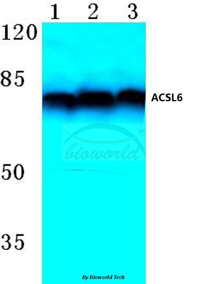 Western blot (WB) analysis of ACSL6 (D531) pAb at 1:500 dilution Lane1:HepG2 cell lysate Lane2:Mouse brain tissue lysate Lane3:Rat brain tissue lysate