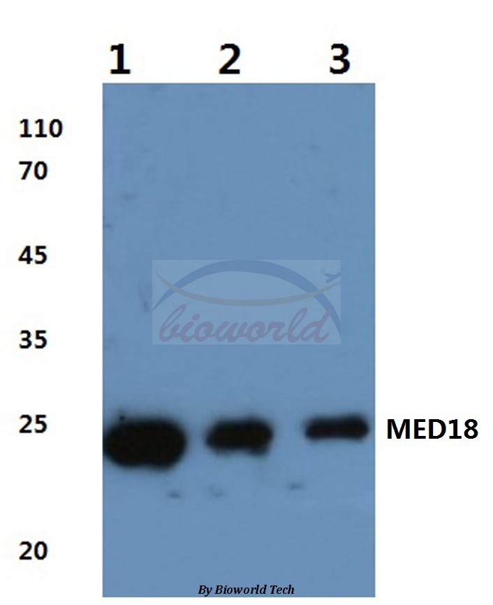 Western blot (WB) analysis of MED18 (V102) pAb at 1:500 dilution Lane1:HEK293T cell lysate Lane2:Mouse brain tissue lysate Lane3:Rat kidney tissue lysate