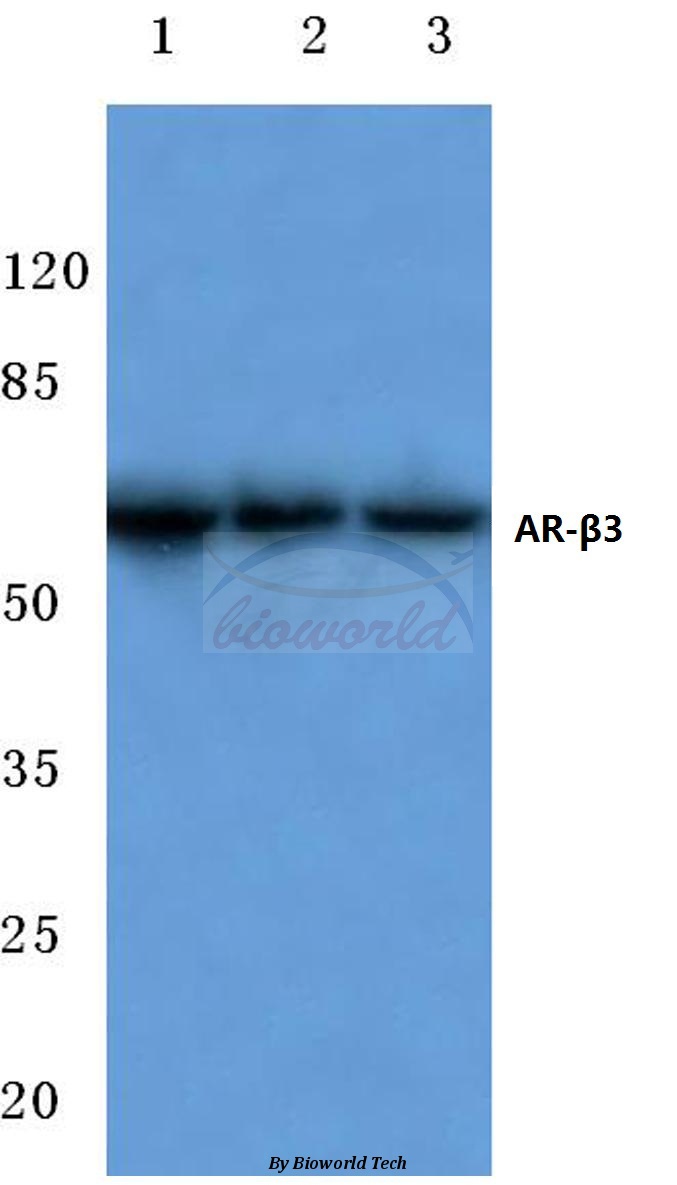 Western blot (WB) analysis of AR-β3 (L291) pAb at 1:500 dilution Lane1:MCF-7 cell lysate Lane2:Mouse kidney tissue lysate Lane3:Rat liver tissue lysate