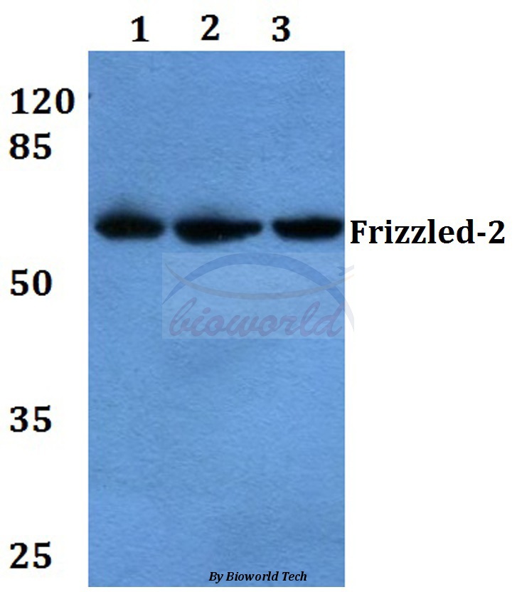 Western blot (WB) analysis of Frizzled-2 (E240) pAb at 1:500 dilution Lane1:Hela whole cell lysate Lane2:sp2/0 whole cell lysate Lane3:H9C2 whole cell lysate