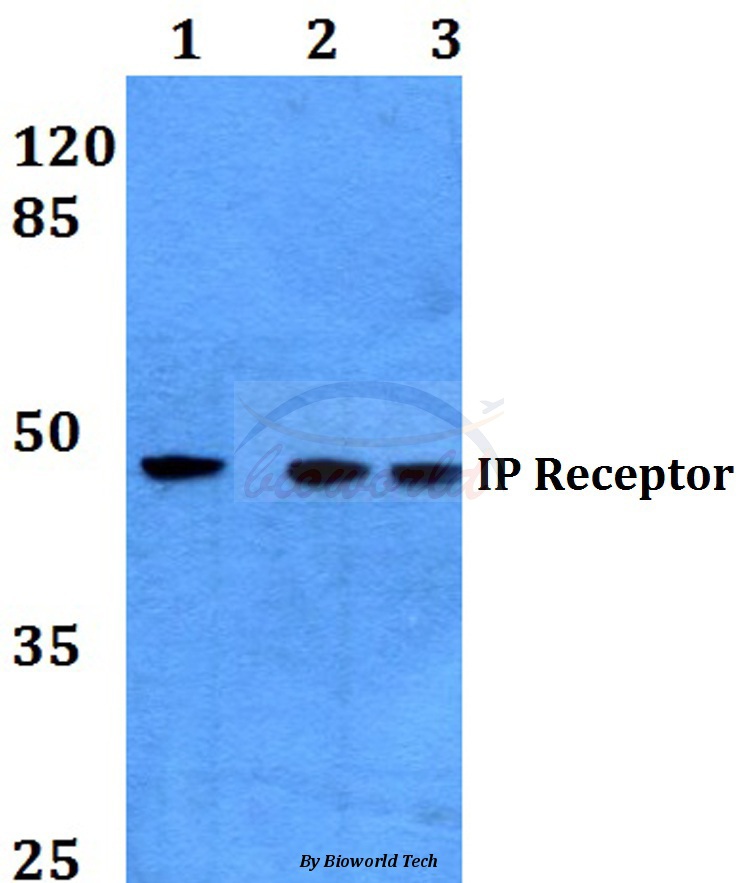 Western blot (WB) analysis of IP Receptor (H237) pAb at 1:500 dilution Lane1:A549 whole cell lysate Lane2:Raw264.7 whole cell lysate Lane3:PC12 whole cell lysate