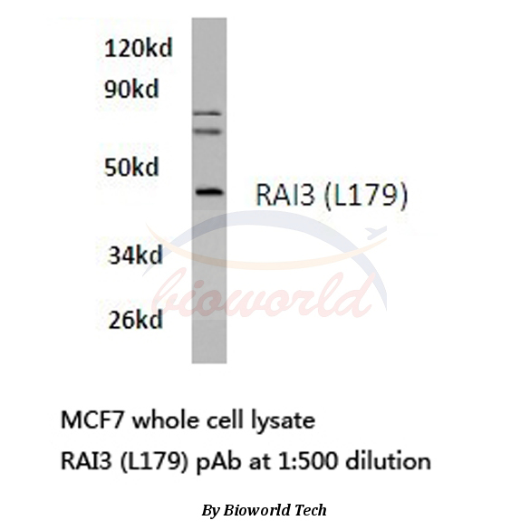 Western blot (WB) analysis of RAI3 (L179) pAb in extracts from MCF7 cells.