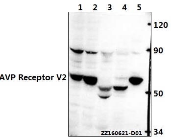 Western blot (WB) analysis of AVP Receptor V2 (L111) pAb at 1:500 dilution Lane1:786-O whole cell lysate(40ug) Lane2:HEK293T whole cell lysate(40ug) Lane3:The kidney tissue lysate of Mouse(40ug) Lane4:The kidney tissue lysate of Rat(40ug) Lane5:PC12 whole