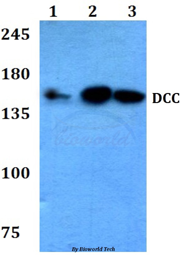 Western blot (WB) analysis of DCC (F465) pAb at 1:500 dilution Lane1:HEK293T whole cell lysate Lane2:sp2/0 whole cell lysate Lane3:PC12 whole cell lysate