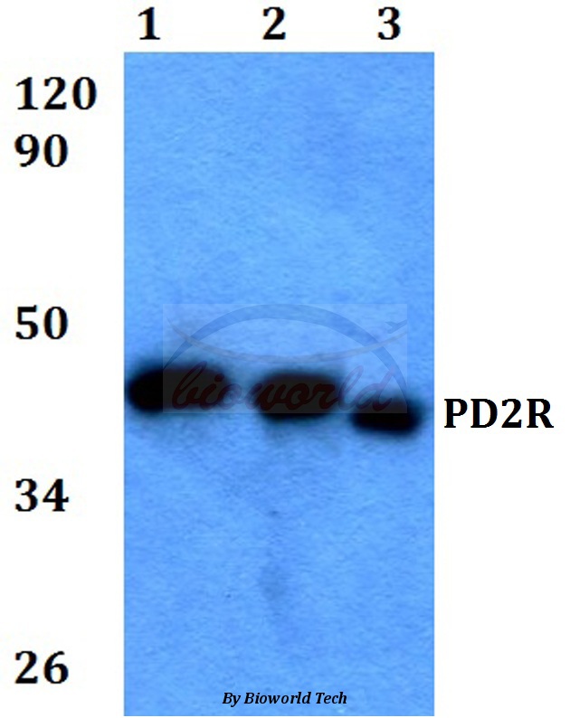 Western blot (WB) analysis of PD2R (E301) pAb at 1:500 dilution Lane1:HEK293T whole cell lysate Lane2:Raw264.7 whole cell lysate Lane3:PC12 whole cell lysate