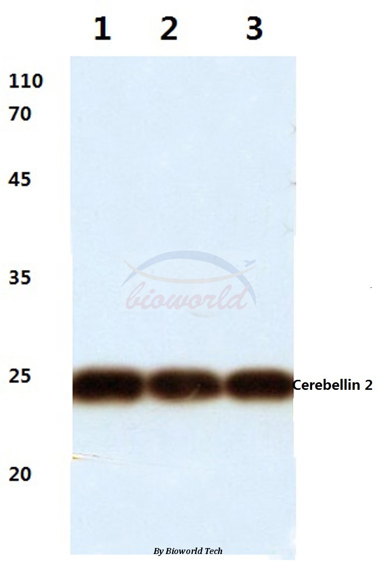 Western blot (WB) analysis of Cerebellin 2 (L202) pAb at 1:500 dilution Lane1:HEK293T cell lysate Lane2:Raw264.7 cell lysate Lane3:Rat kidney tissue lysate