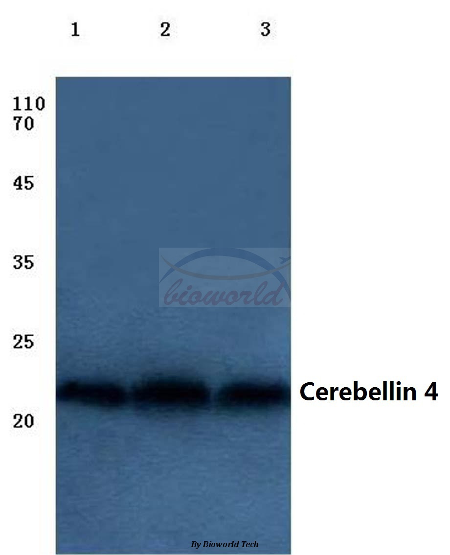 Western blot (WB) analysis of Cerebellin 4 (K178) pAb at 1:500 dilution Lane1:HEK293T cell lysate Lane2:sp2/0 cell lysate Lane3:Rat liver tissue lysate