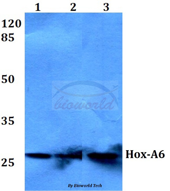Western blot (WB) analysis of Hox-A6 (P135) pAb at 1:500 dilution Lane1:Jurkat whole cell lysate Lane2:NIH-3T3 whole cell lysate Lane3:PC12 whole cell lysate