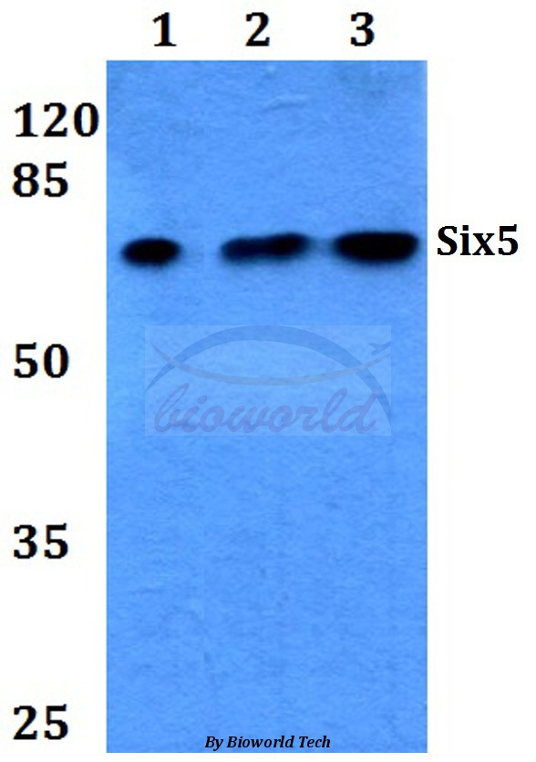 Western blot (WB) analysis of Six5 (L237) pAb at 1:500 dilution Lane1:HEK293T whole cell lysate Lane2:Raw264.7 whole cell lysate Lane3:PC12 whole cell lysate