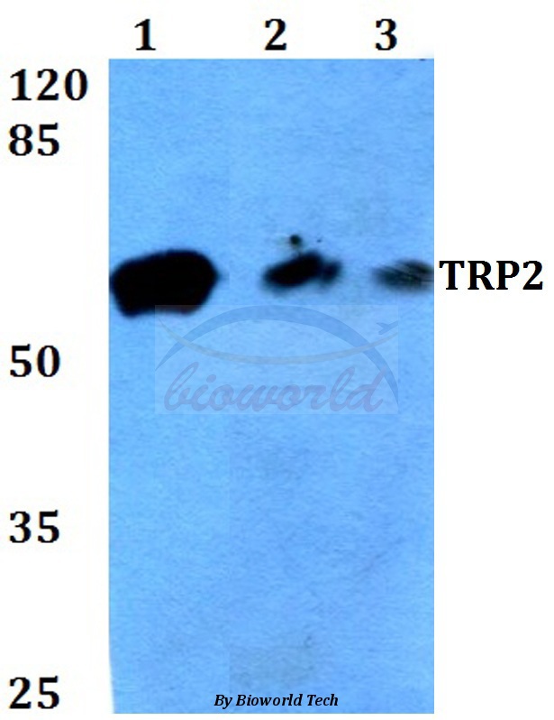 Western blot (WB) analysis of TRP2 (K89) pAb at 1:500 dilution Lane1:HEK293T whole cell lysate Lane2:sp2/0 whole cell lysate Lane3:PC12 whole cell lysate