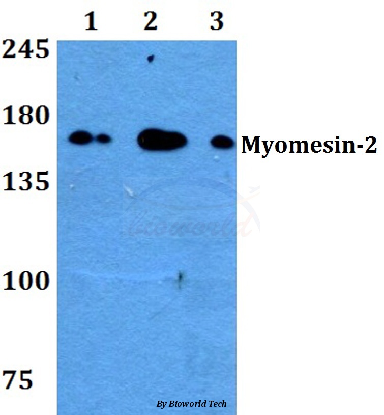 Western blot (WB) analysis of Myomesin-2 (Y644) pAb at 1:500 dilution Lane1:HEK293T whole cell lysate Lane2:sp2/0 whole cell lysate Lane3:PC12 whole cell lysate