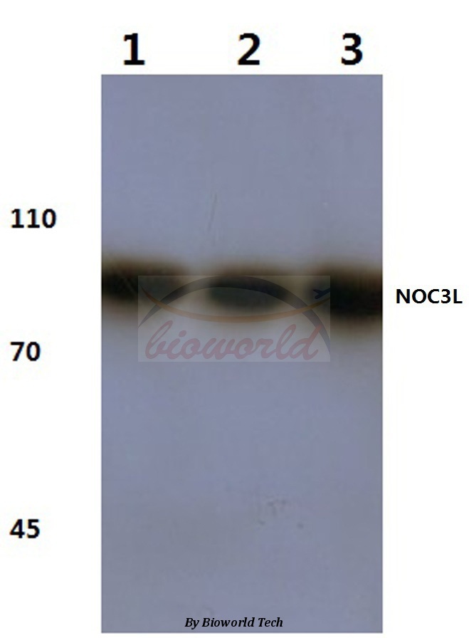Western blot (WB) analysis of NOC3L (F447) pAb at 1:500 dilution Lane1:HEK293T cell lysate Lane2:Mouse liver tissue lysate Lane3:Rat kidney tissue lysate