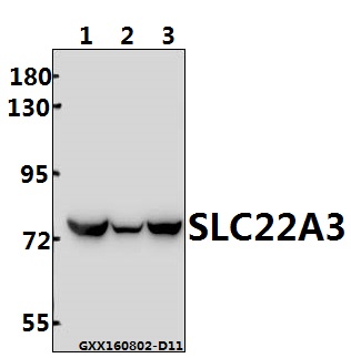 Western blot (WB) analysis of SLC22A3 (Q306) pAb at 1:500 dilution Lane1:786-O whole cell lysate(40ug) Lane2:L02 whole cell lysate(40ug) Lane3:HEK293T whole cell lysate(40ug)