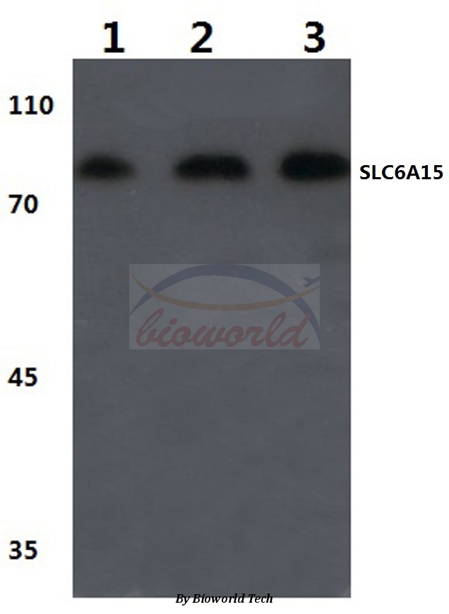 Western blot (WB) analysis of SLC6A15 (W64) pAb at 1:500 dilution Lane1:HEK293T cell lysate Lane2:Mouse brain tissue lysate Lane3:Rat brain tissue lysate