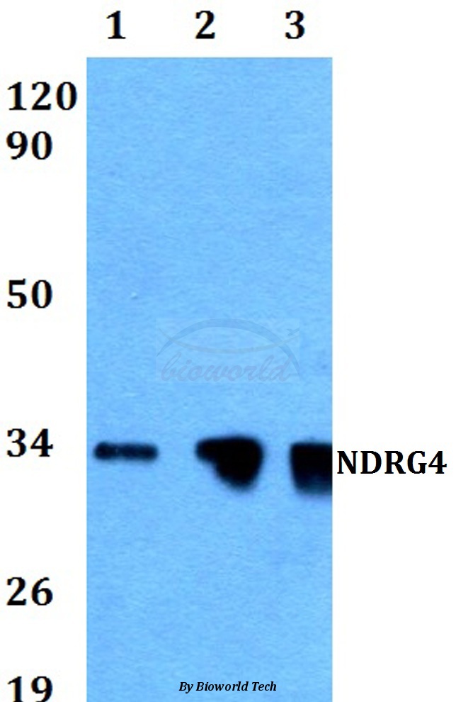 Western blot (WB) analysis of NDRG4 (G217) pAb at 1:500 dilution Lane1:MCF-7 whole cell lysate Lane2:NIH-3T3 whole cell lysate Lane3:PC12 whole cell lysate