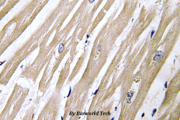 Immunohistochemistry (IHC) analyzes of NDRG4 (G217) pAb in paraffin-embedded human heart tissue.