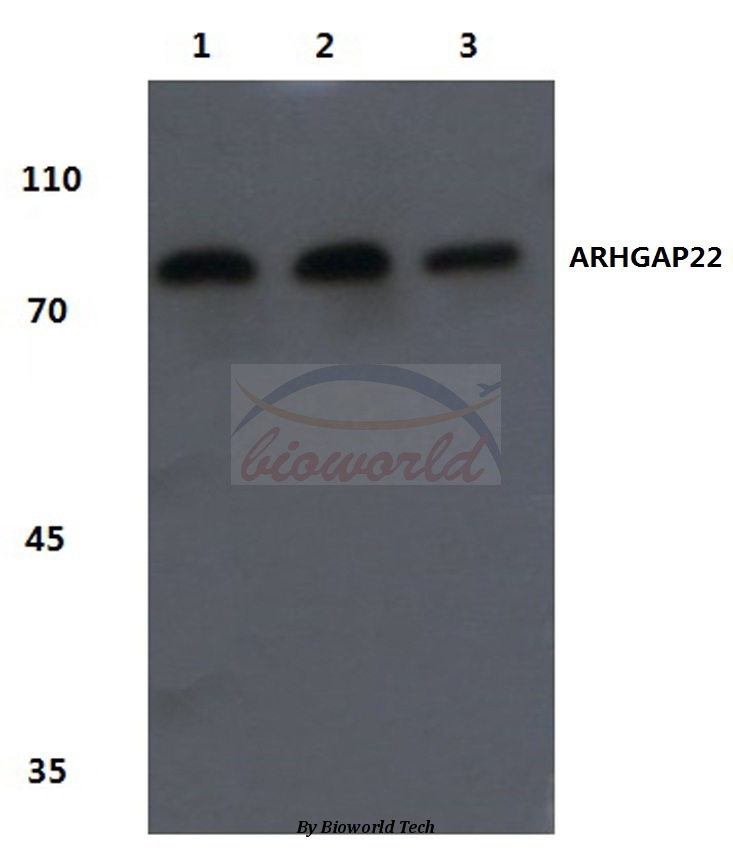 Western blot (WB) analysis of ARHGAP22 (R595) pAb at 1:500 dilution Lane1:Hela cell lysate Lane2:Mouse kidney tissue lysate Lane3:Rat kidney tissue lysate