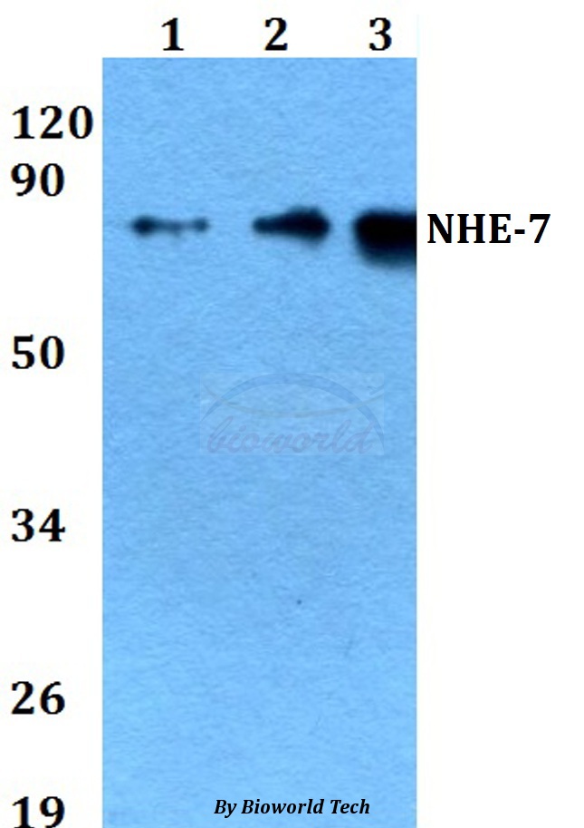 Western blot (WB) analysis of NHE-7 (D566) pAb at 1:500 dilution Lane1:HEK293T whole cell lysate Lane2:Raw264.7 whole cell lysate Lane3:PC12 whole cell lysate