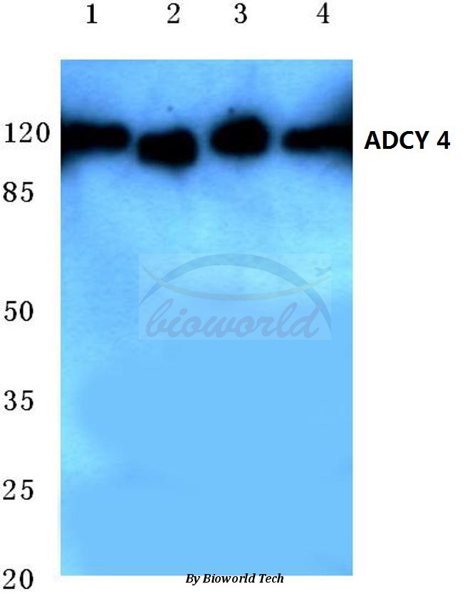 Western blot (WB) analysis of ADCY 4 (L226) pAb at 1:500 dilution Lane1:Hela cell lysate Lane2:Jurkat cell lysate Lane3:sp2/0 cell lysate Lane4:PC12 cell lysate