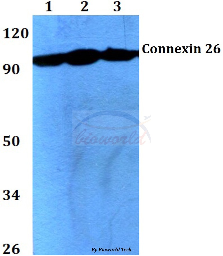 Western blot (WB) analysis of mGluR-2/3 (N867) pAb at 1:500 dilution Lane1:HEK293T whole cell lysate Lane2:Mouse brain tissue lysate Lane3:PC12 whole cell lysate